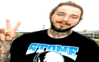 Post Malone Teeth: What Happened to His Grill and Veneers?
