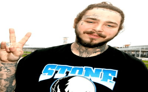 Post Malone Teeth: What Happened to His Grill and Veneers?