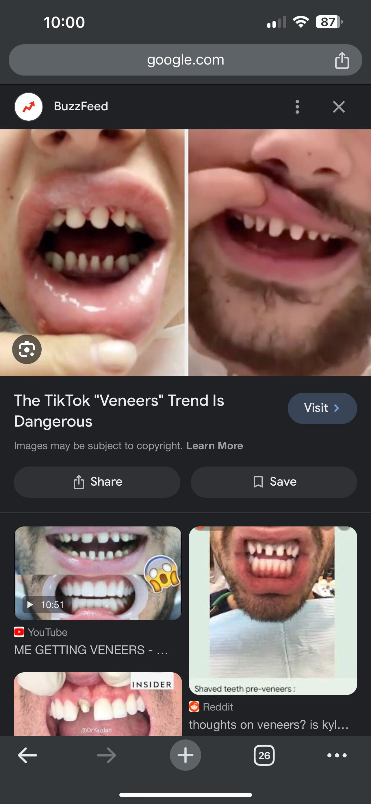 Post Malone Teeth: What Happened to His Grill and Veneers?