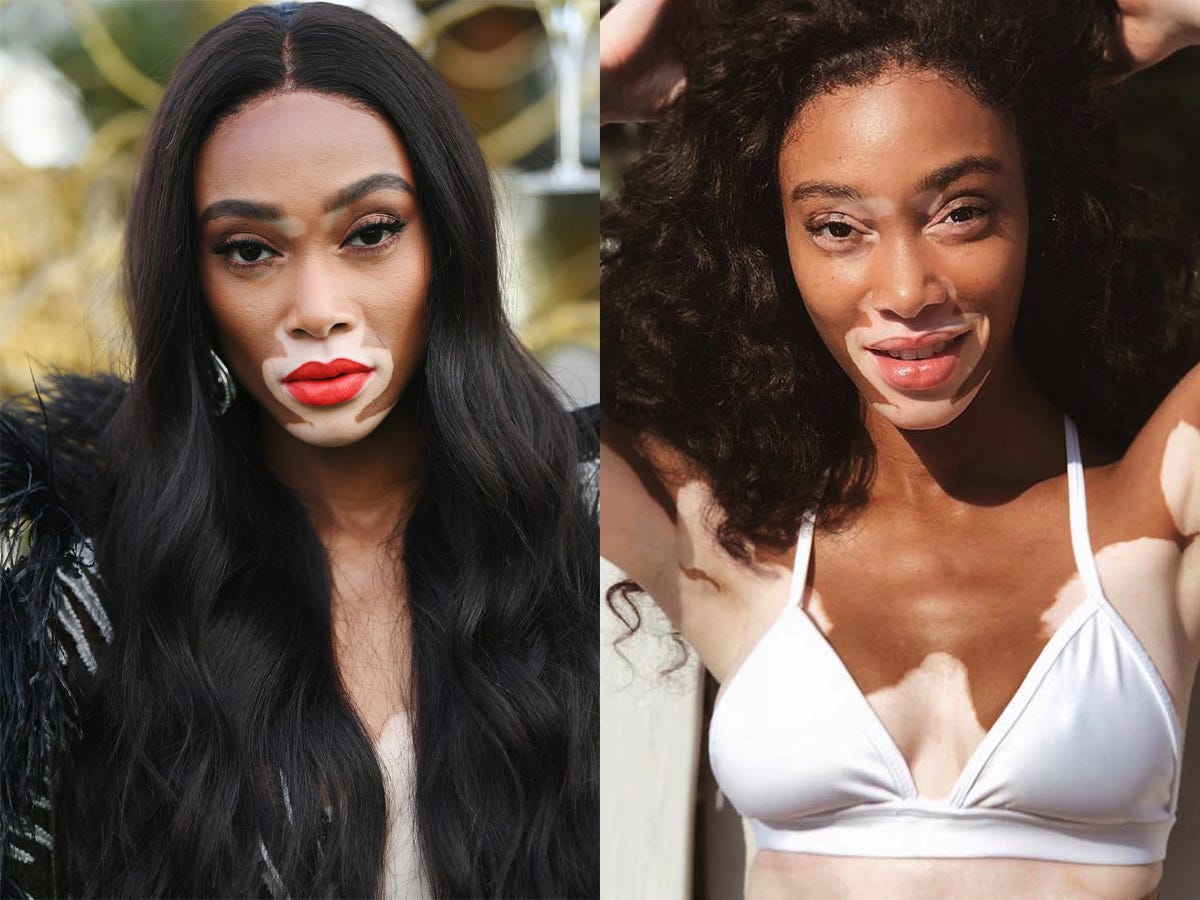 Celebrities Looking Bad: Shocking Pics of Stars Without Makeup!
